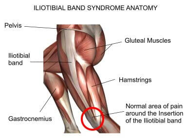 Iliotibial Band Syndrome Anatomy